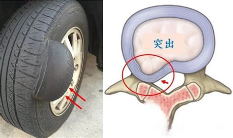 突出 凸出|突出和凸出用法有什么区别